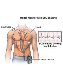 holter monitor copy (1)