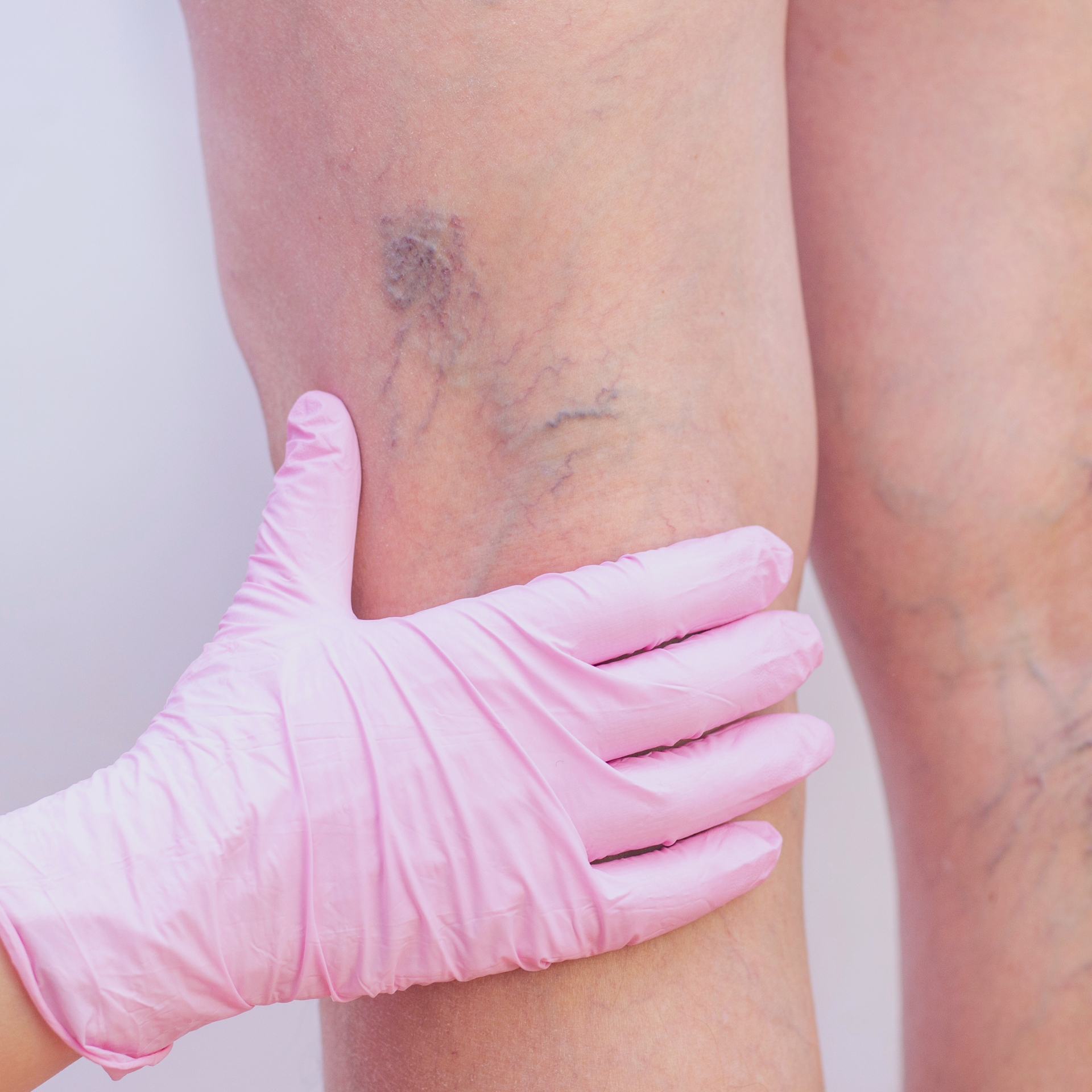 vein clinic image