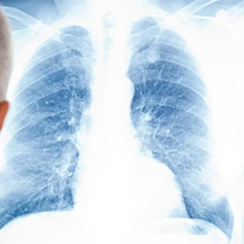 Pulmonology_Home_LungCenter_560x300