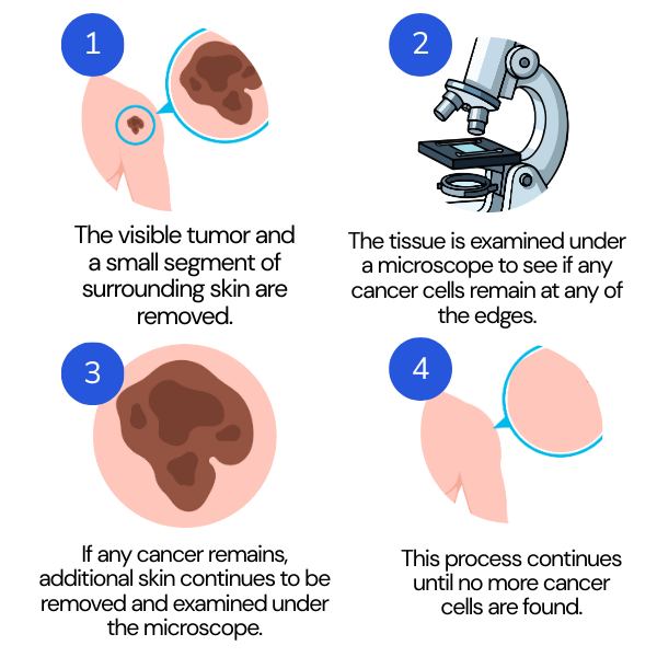 MOHs Surgery Newspaper ad 0114 (1)
